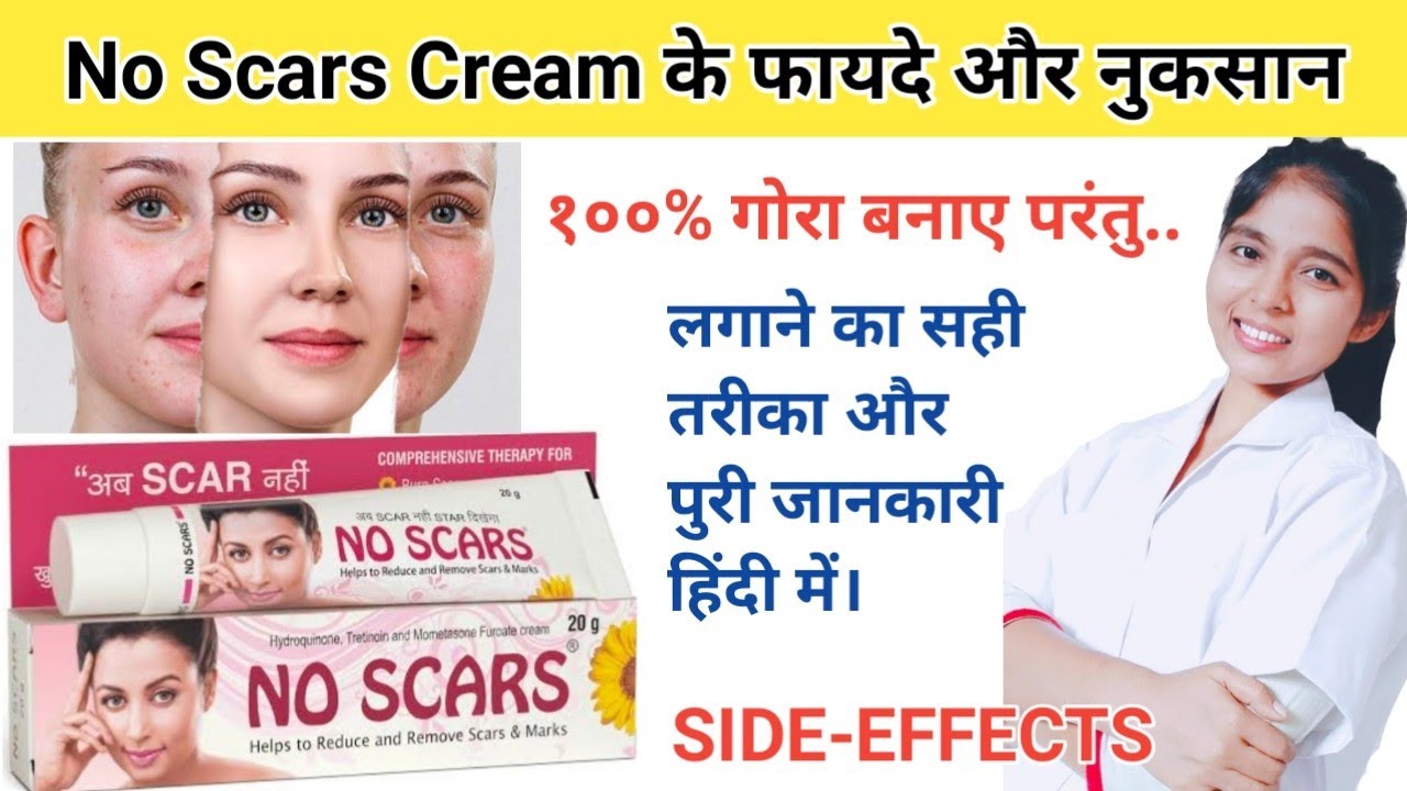 No Scars Cream Review In Hindi | No scars cream use karne ka tarika | No scars cream side-effects