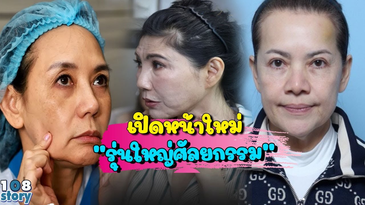 เปิดหน้าใหม่ 7 ดาราสาวรุ่นใหญ่ หลังตัดสินใจศัลยกรรม สวยจนลืมไปเลยว่าจะเข้าเลข 6 แล้ว