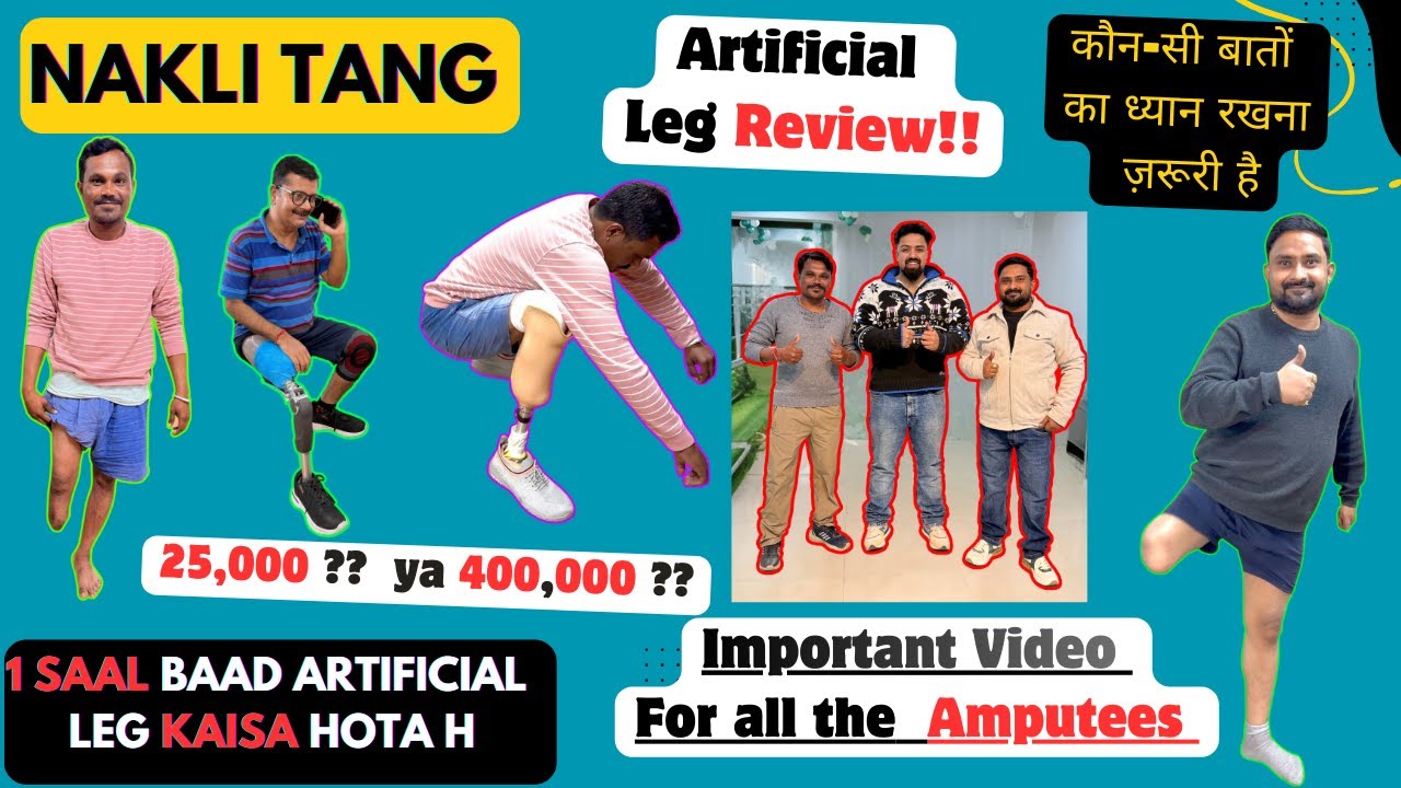 🤯🤯Best Artificial Limbs Clinic in India | Prosthetic Leg Clinic | 