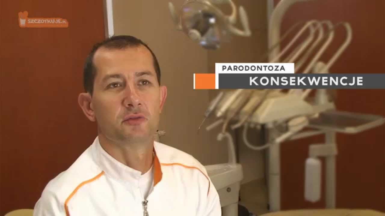 Paradontoza (parodontoza) objawy, leczenie - lek. dent. Mateusz Sowiński, Łódź - Szczotkuje.pl