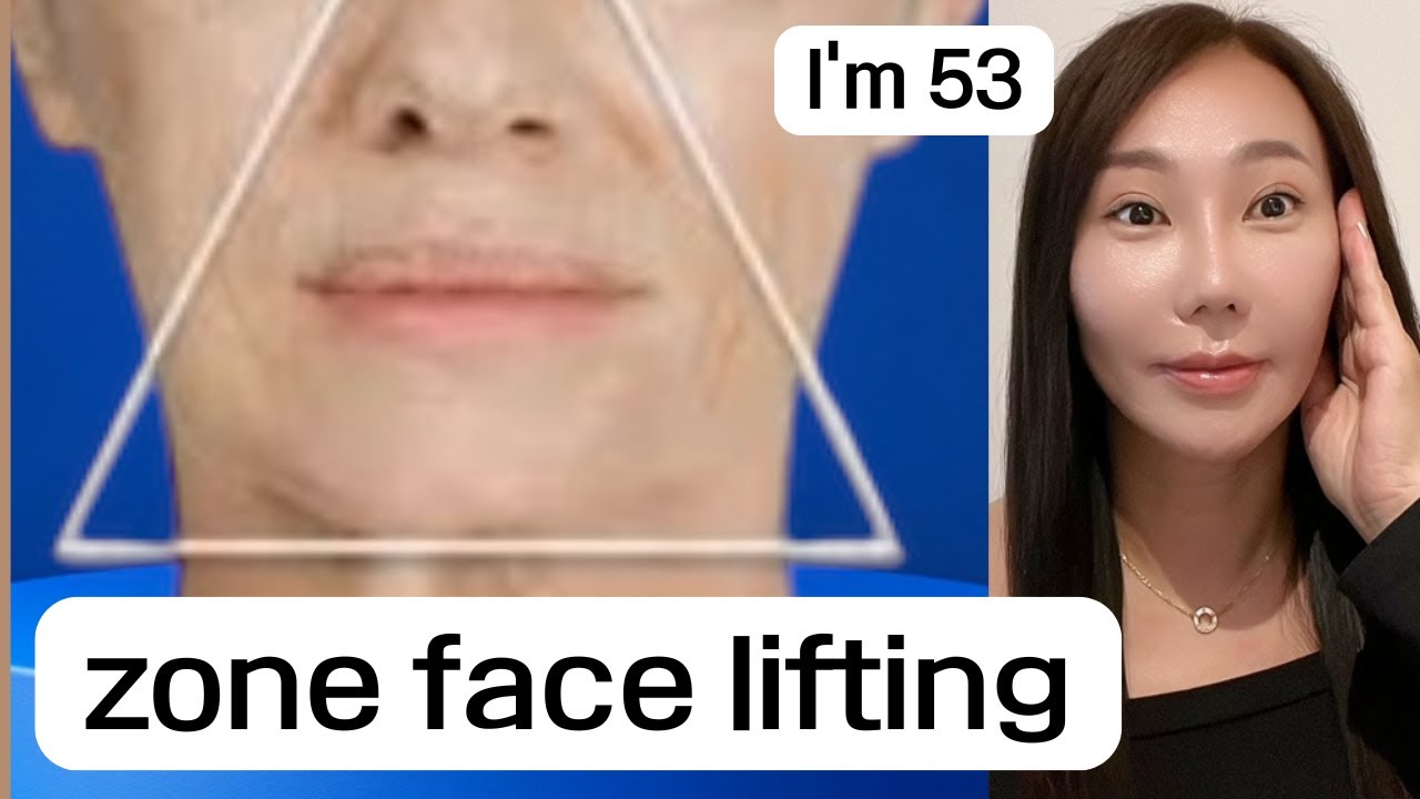 5 Min Power Face Lifting l Smile Lines Iifted l New Face in 5 l No Talk Practice Version is attached