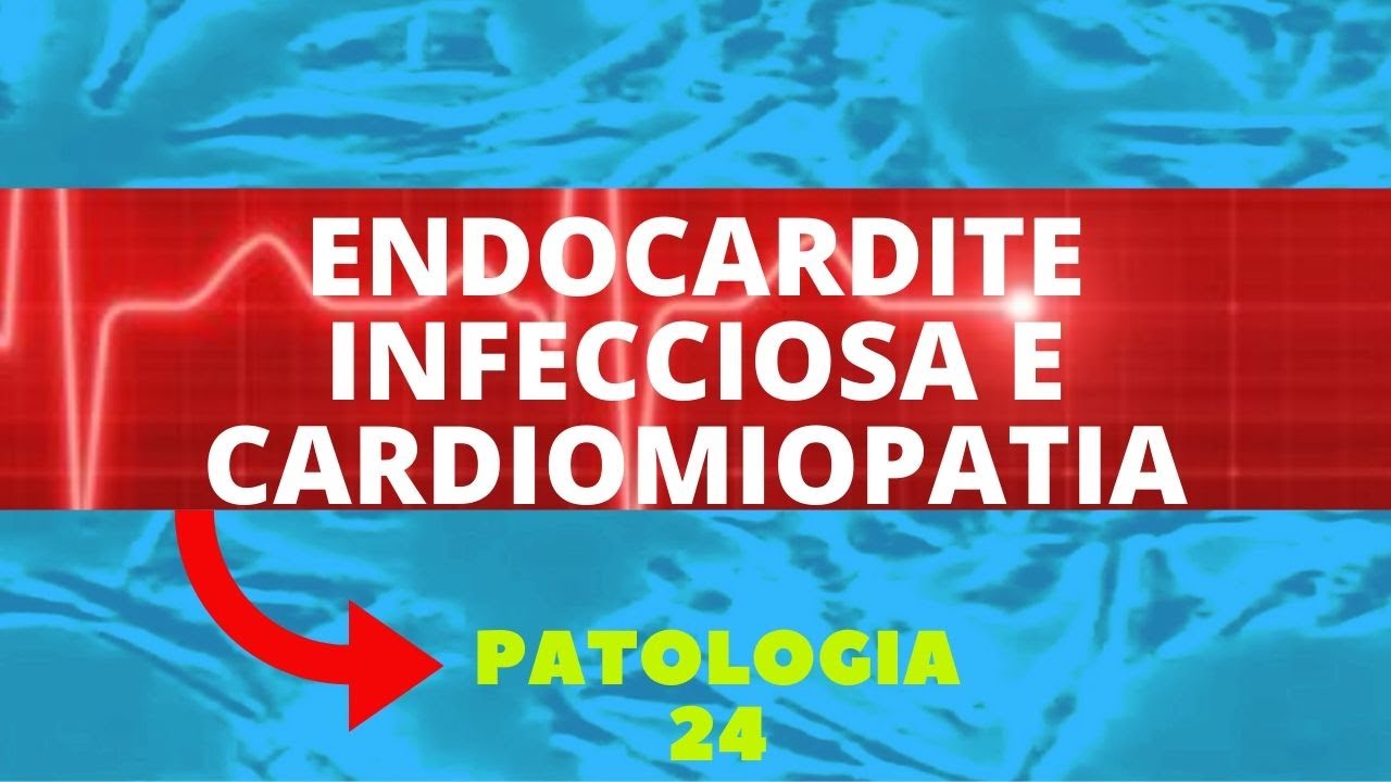 ENDOCARDITE INFECCIOSA E CARDIOMIOPATIA - PATOLOGIA 24