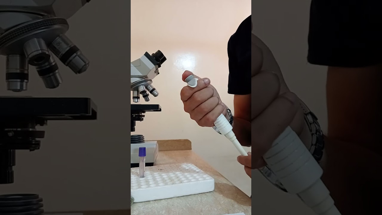 تحليل Albumin , T.Protein عملي في المعمل _ دبلومة الكيميائي _ حلقة 8