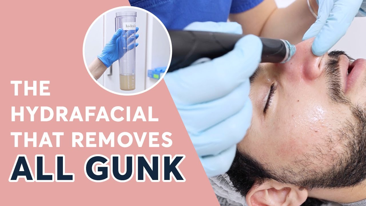 The Hydrafacial That Removes All Gunk | The 6 Step Hydrafacial