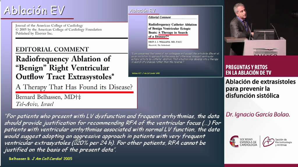 Ablación de extrasístoles para prevenir la disfunción sistólica. Dr. Ignacio García Bolao.