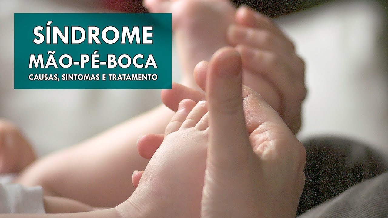 Síndrome mão-pé-boca – causas, sintomas e tratamento | Sua Saúde na Rede