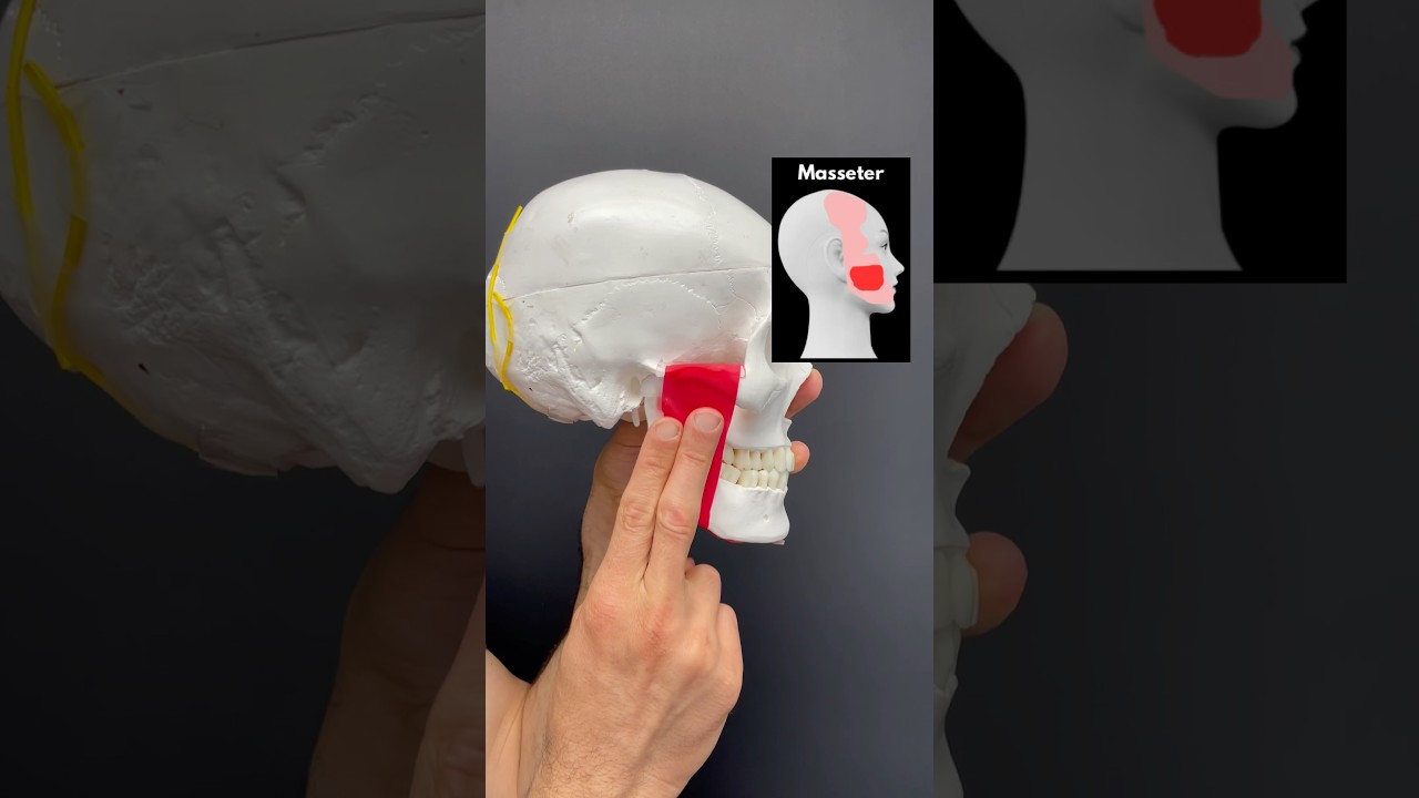 Head Pain Muscle Release Series Part 2- Masseter  #headacherelief #headachetreatment #series