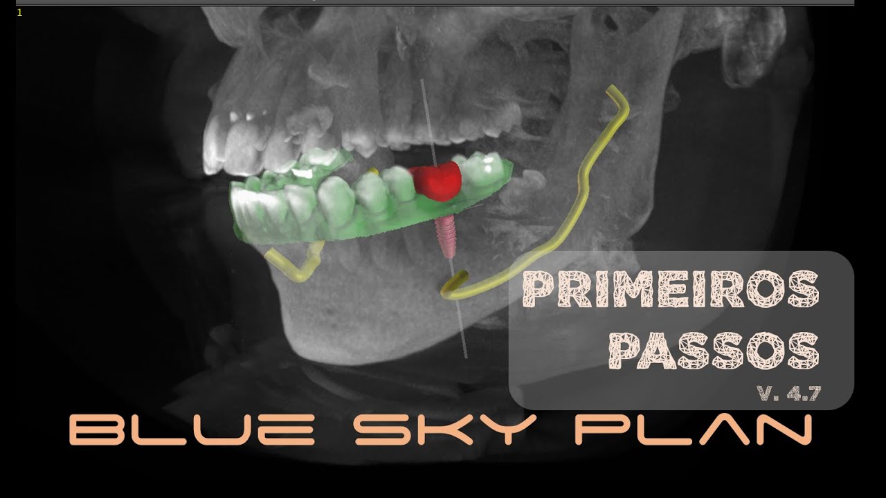 Primeiros Passos no Blue Sky Plan