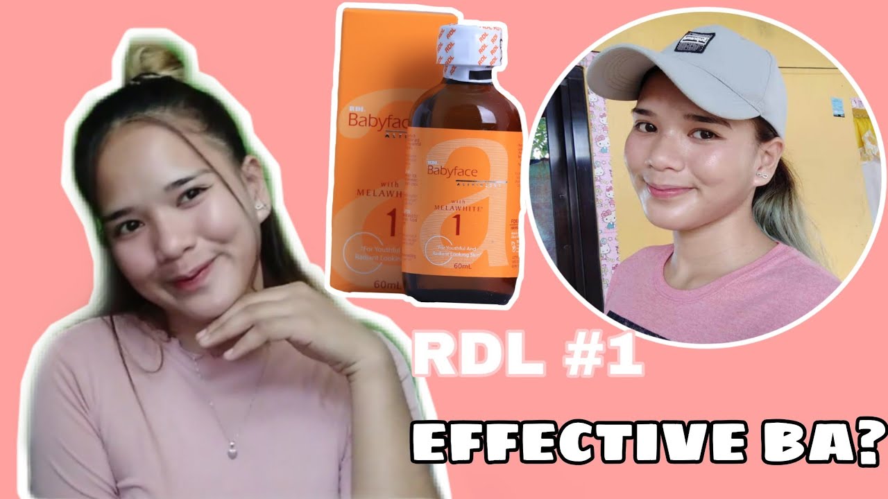 VLOG 010 | RDL BABYFACE #1 HONEST REVIEW & TIPS