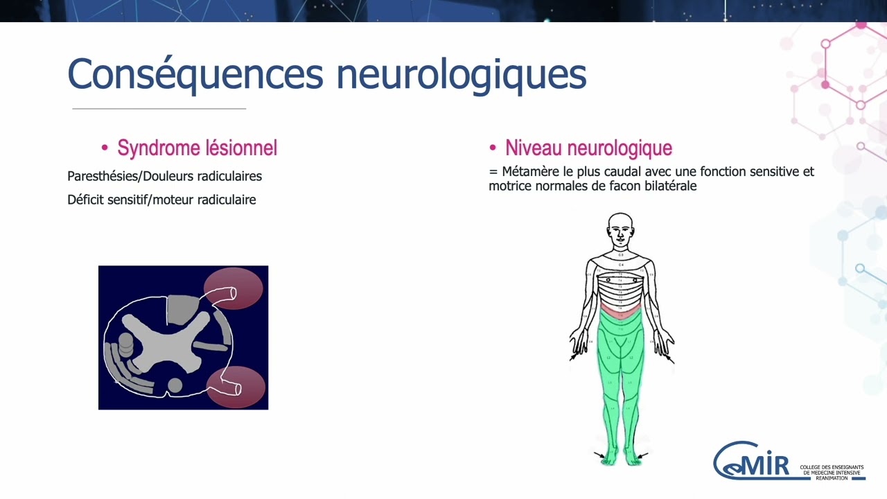 57 5 Traumatismes rachis physiopathologie