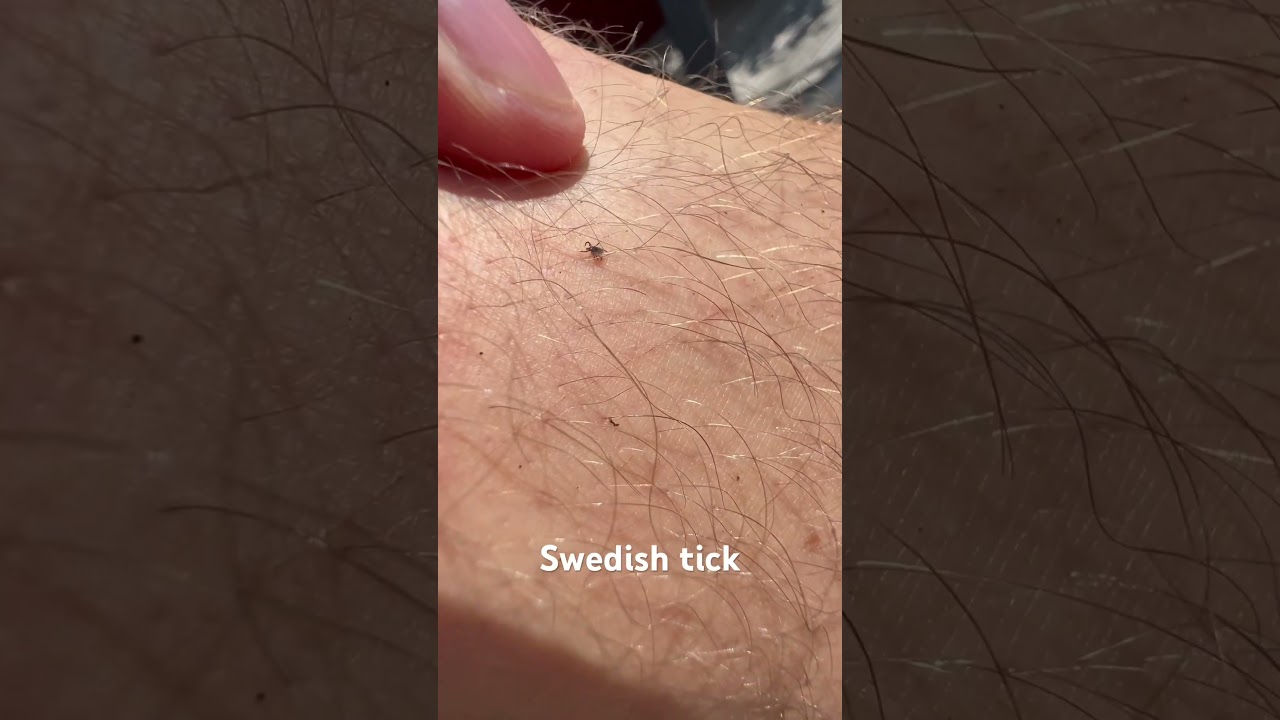 Tick from the woods of Sweden #trailrunning #shorts