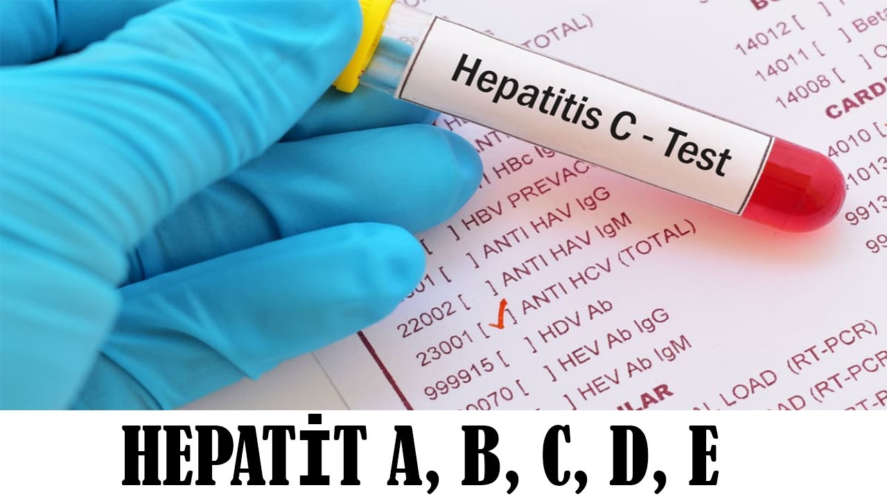 Hepatit A, B, C, D, E Xəstəlikləri