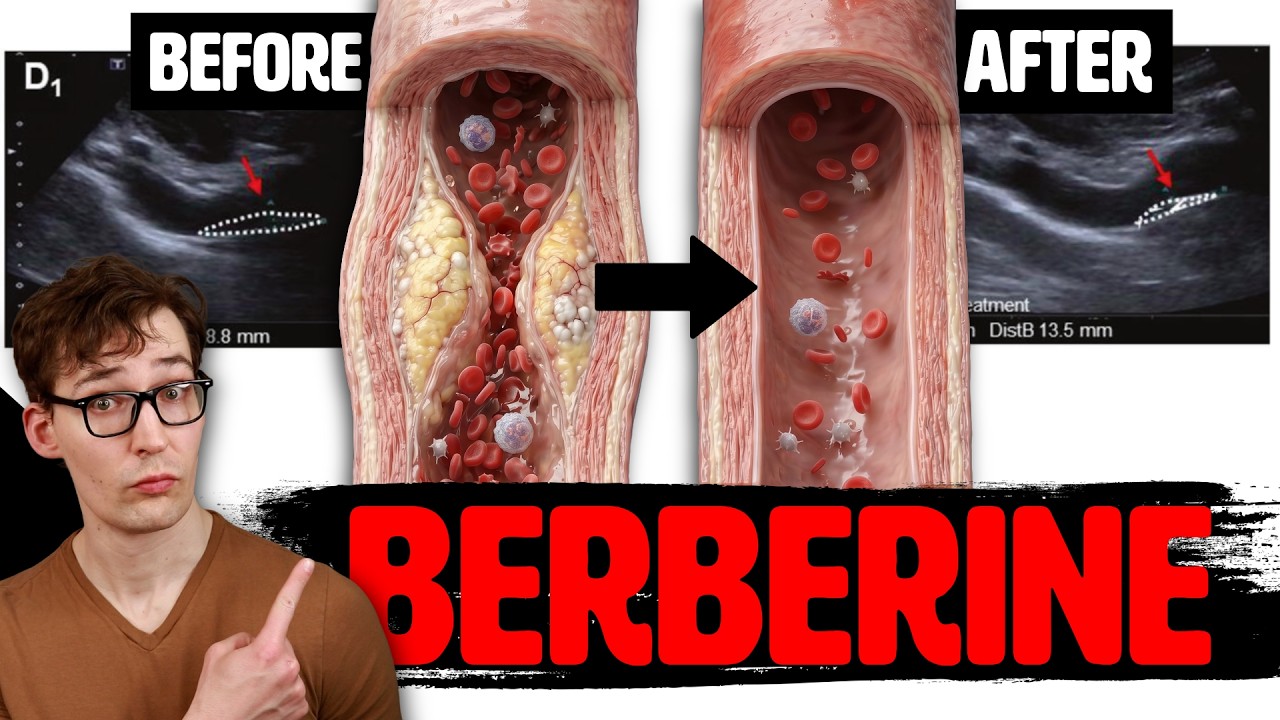 4 Months on Berberine: Reversing Arterial Plaque