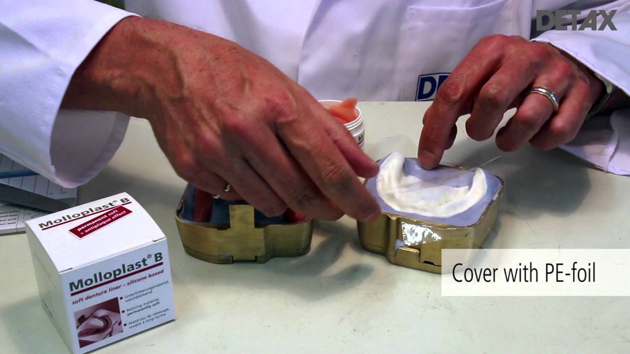 Molloplast® B
