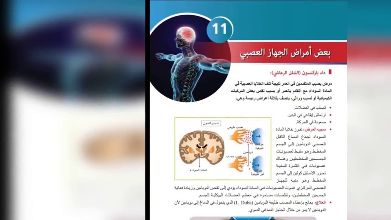 بكالوريا علوم بعض أمراض الجهاز العصبي 🧠💯⚘