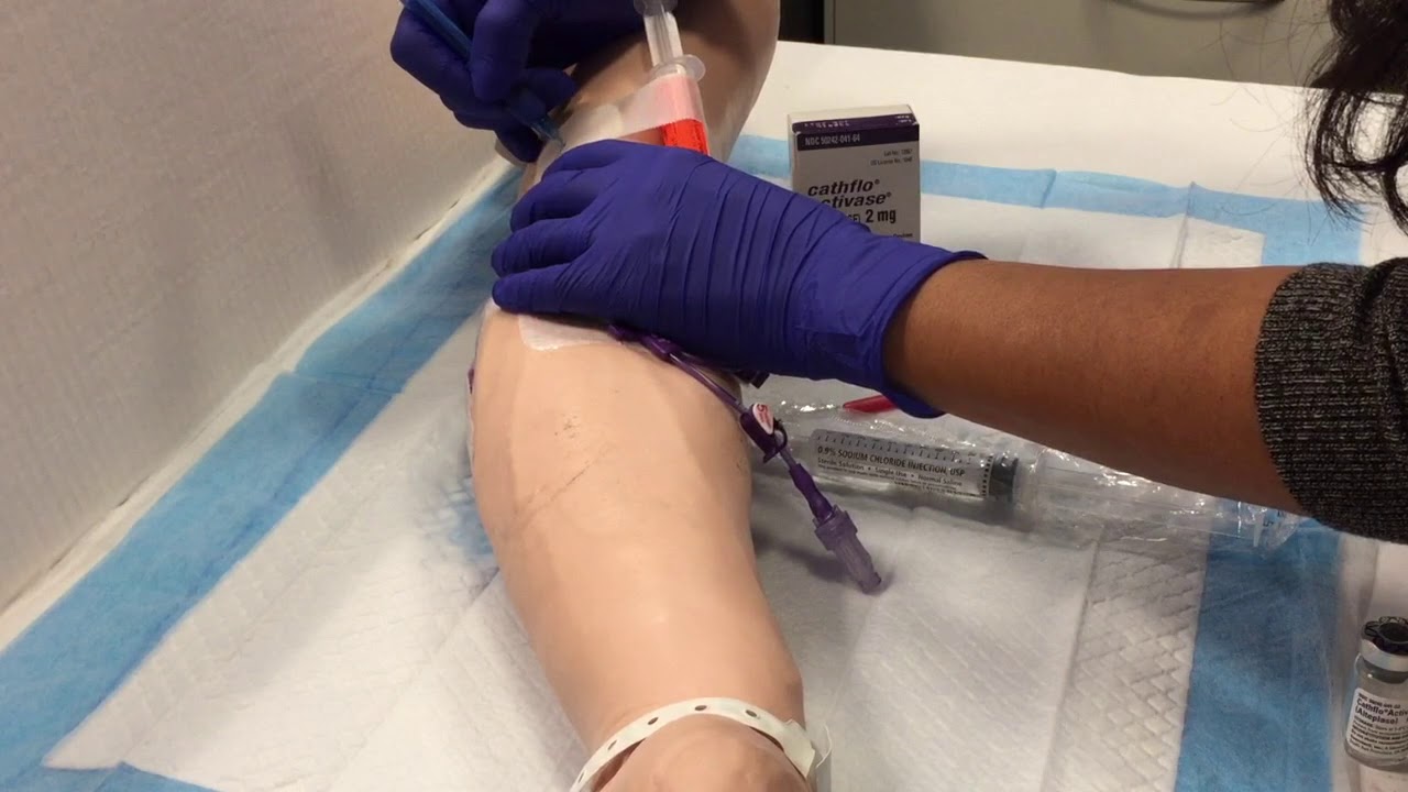 declotting central lines