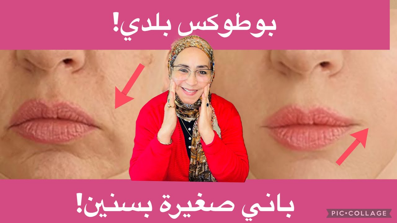 ملامح أصغر بسنين! أقوى بوطوكس طبيعي حتى لو فوق 50… النتيجة كتبان!