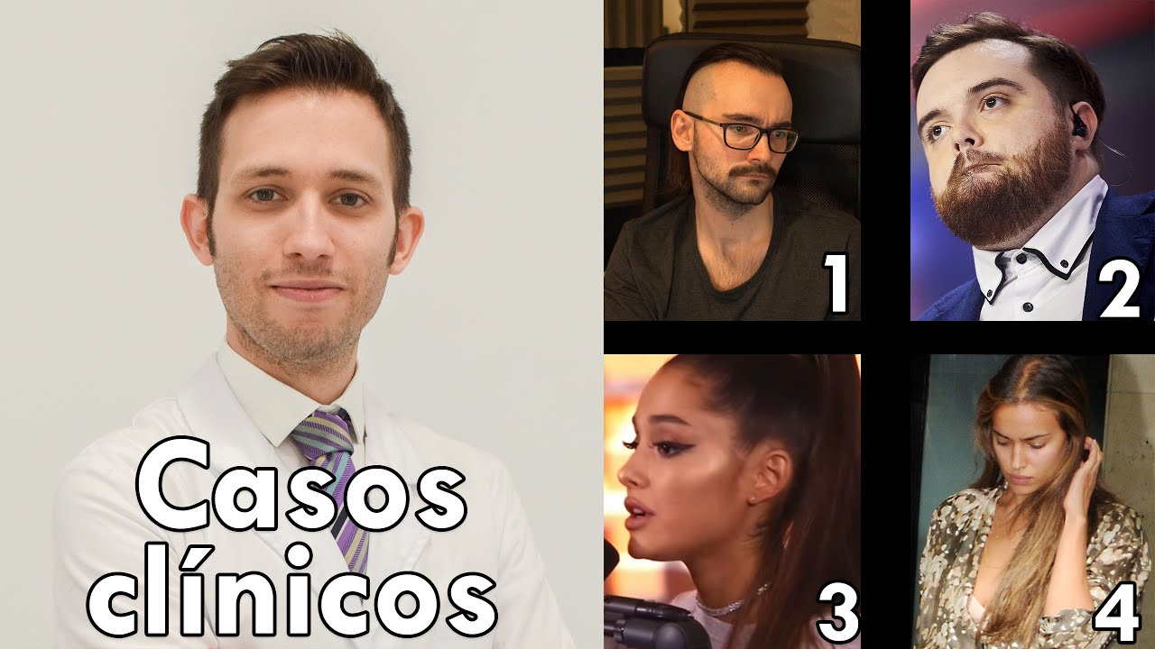 Médico analiza pérdida de pelo