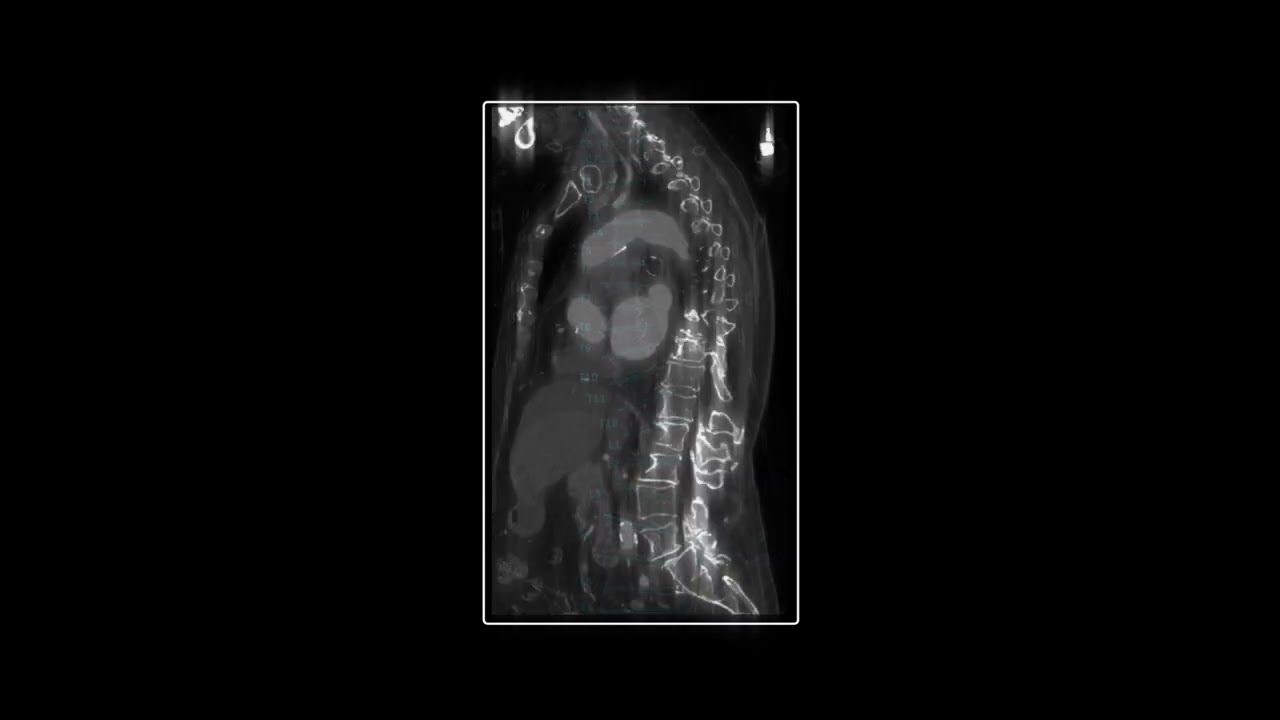 Spine Auto Views clinical videos