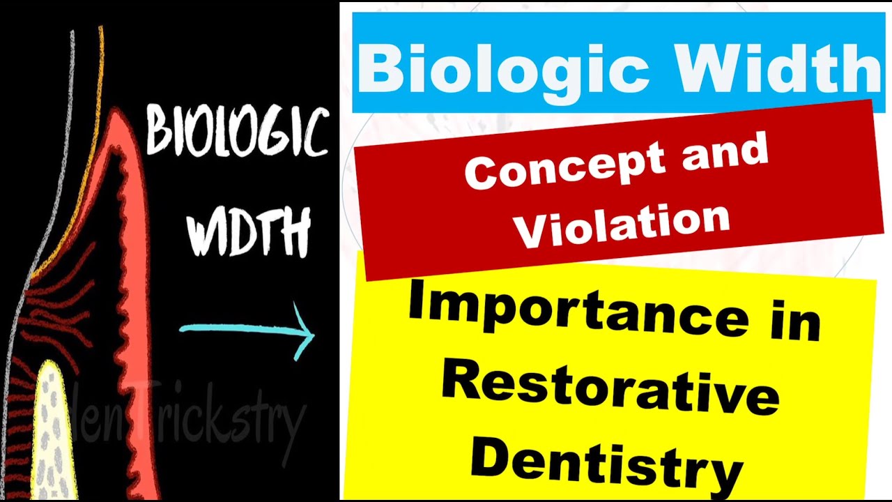 Biologic Width (Supracrestal Tissue Attachment)/ Violation / Importance in Restorative Dentistry.