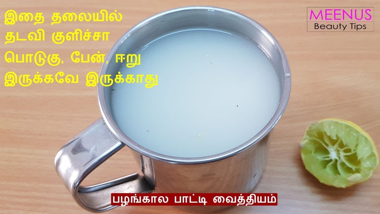 பொடுகு பேன் ஈறு நீங்க எளிமையான வழி | Dandruff Home Remedy in Tamil