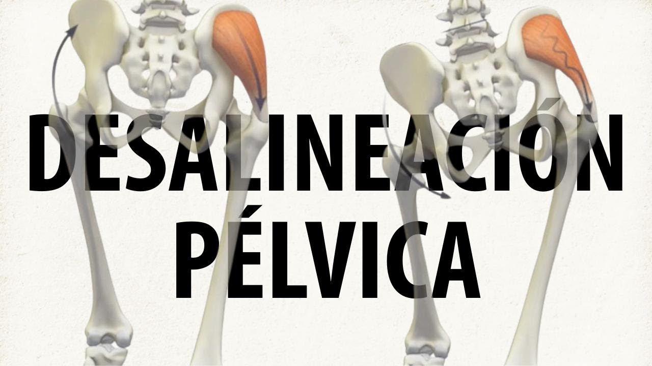 Desalinhamento pélvico? Experimente este exercício simples!