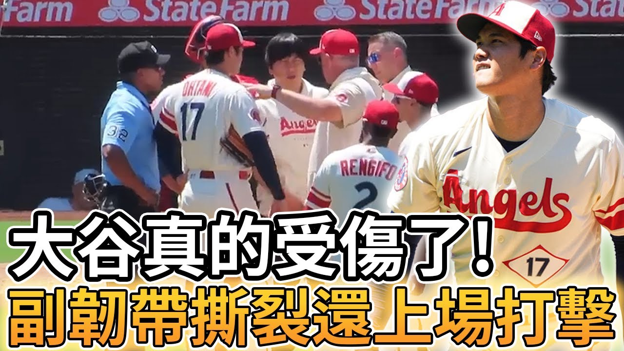 【MLB 美國職棒】大谷翔平真的受傷了! 副韌帶撕裂還上場打擊 本季投手提前關機