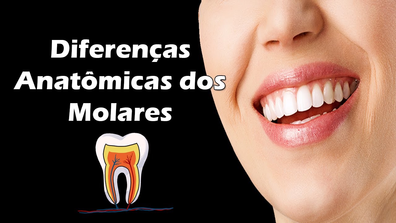 Diferenças Entre Molares Superiores e Molares Inferiores - Aula de Anatomia Dental