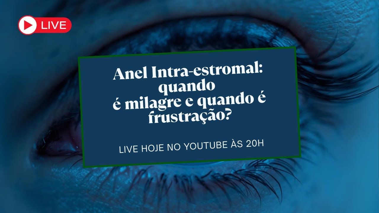 Anel Intra-estromal: quando é milagre e quando é frustração?
