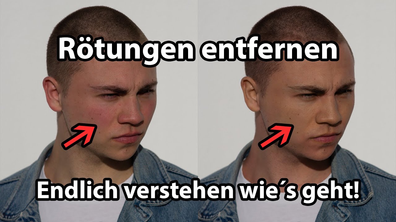 Rötungen von der Haut entfernen |Photoshop Tutorial|