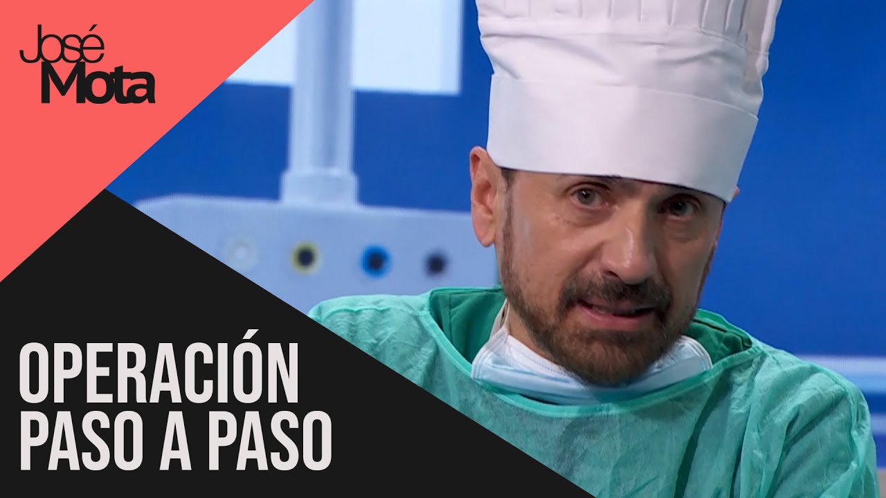 Operación paso a paso👀​🧑‍🍳​​ | José Mota