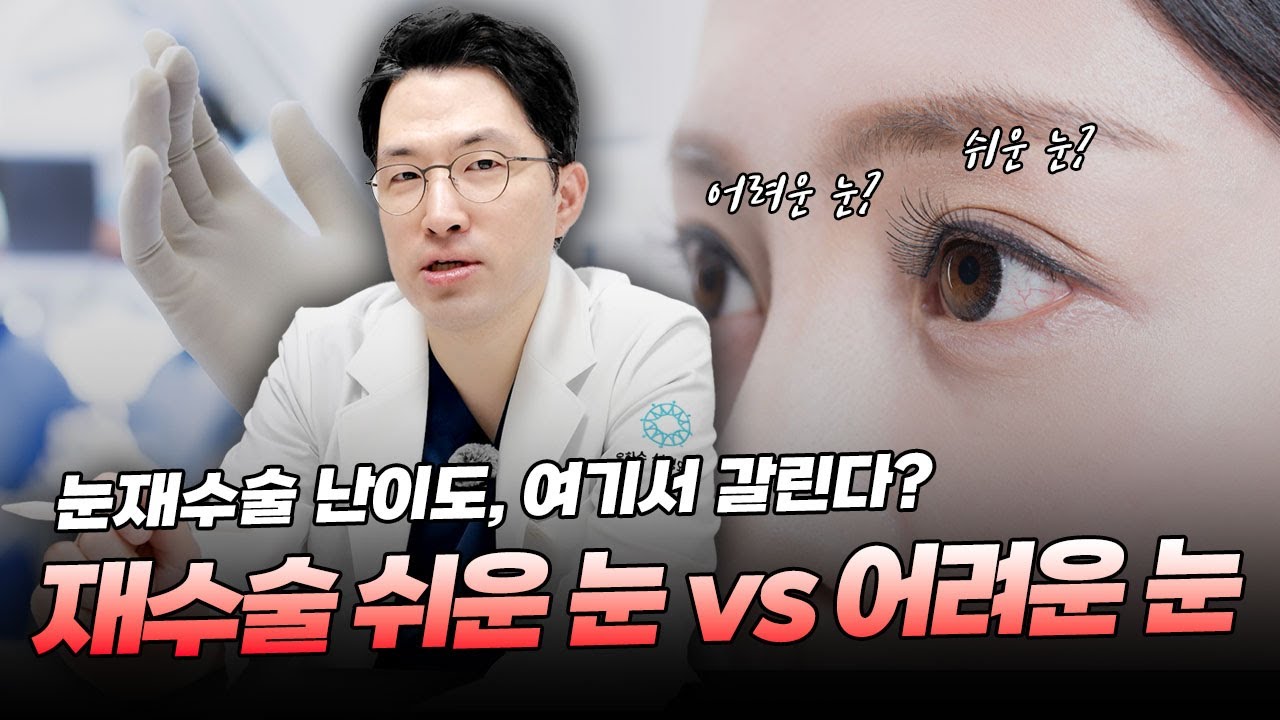 재수술 난이도는 왜 달라질까? 쉬운 눈과 어려운 눈 기준 총정리!
