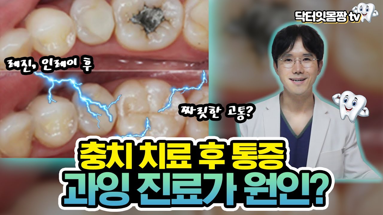 레진, 인레이 후 통증 및 시림 - 충치과잉진료? 레진중합수축? (바쁘신 분들 03:00~)