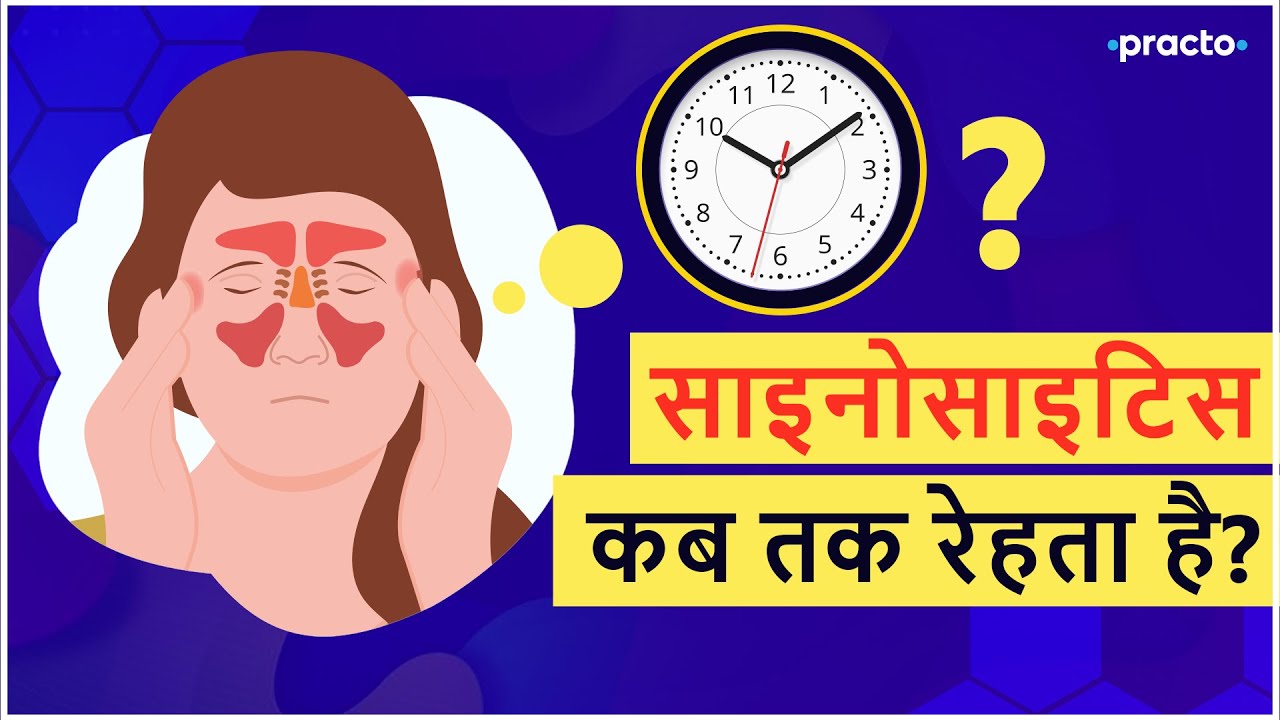 Sinusitis kya hota hai | Types of sinusitis || Practo