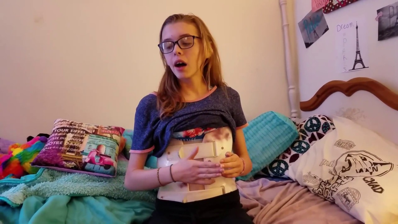 how to sleep in your scoliosis brace with no pain *hacks