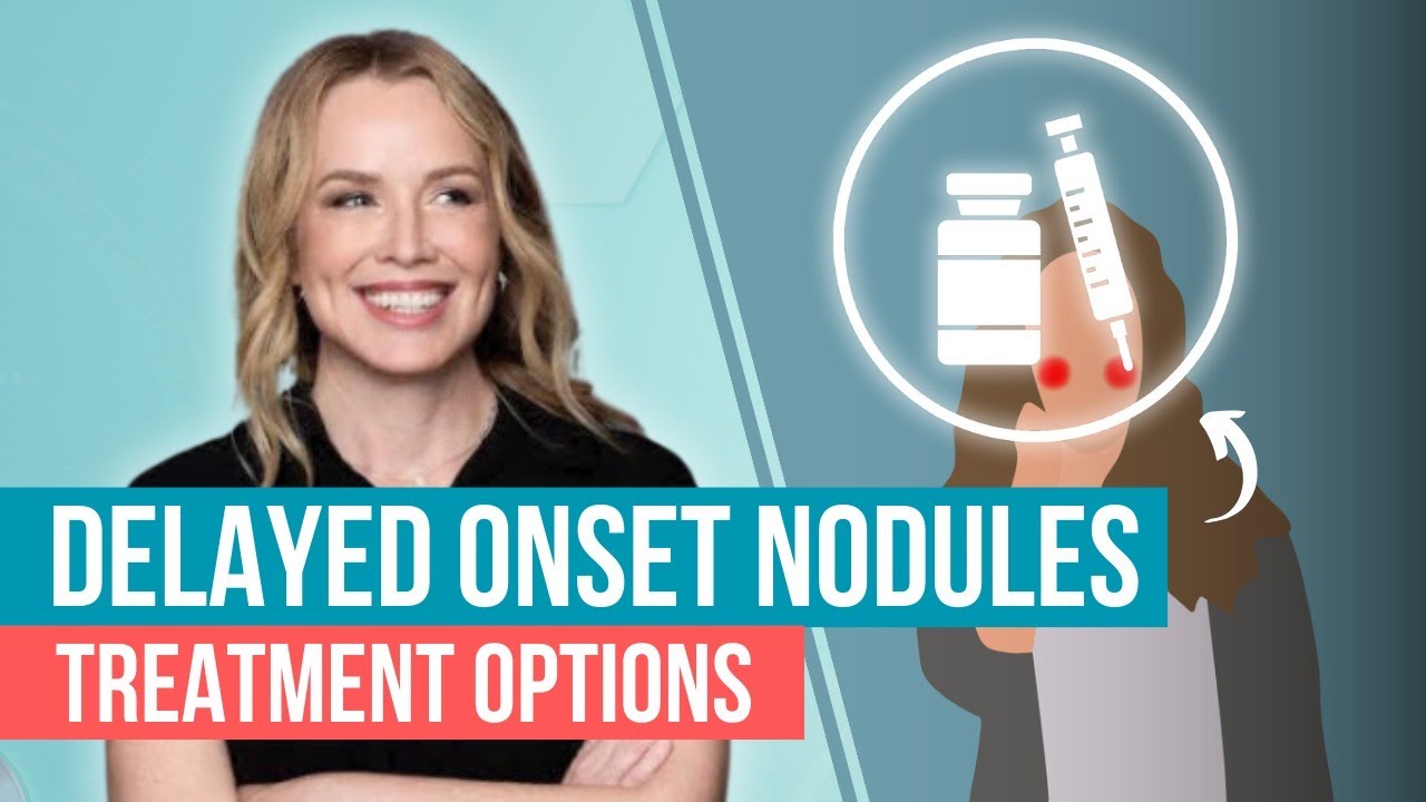 Delayed Onset Nodules after Dermal Fillers: Treatment Options