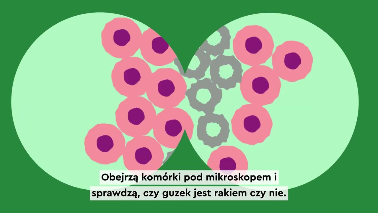 What is cancer? (Polish) | Czym jest nowotw&oacute;r? (język polski) | Macmillan Cancer Support