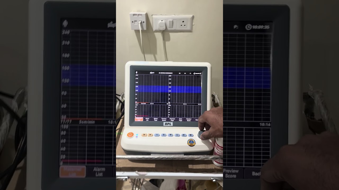 Fetal Monitor CTG /NST BPL 9853/9854