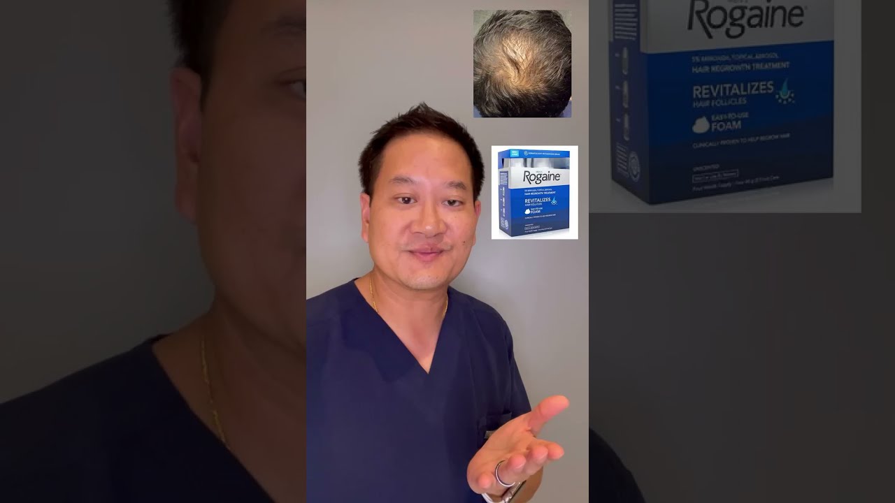 Hair Loss Treatment Tip - How to use Rogaine or Minoxidil successfully