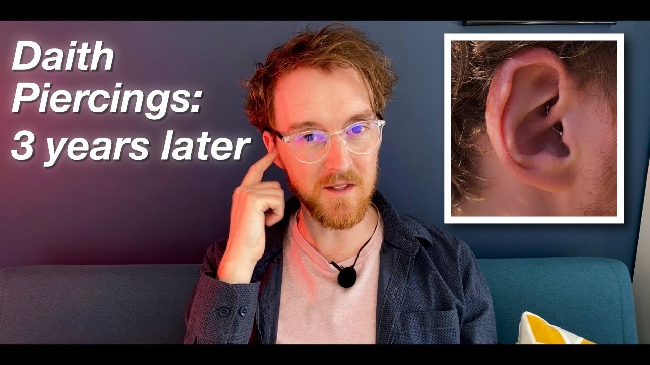 Do Daith Piercings help with Migraine? A long term review. 3 Years Later.