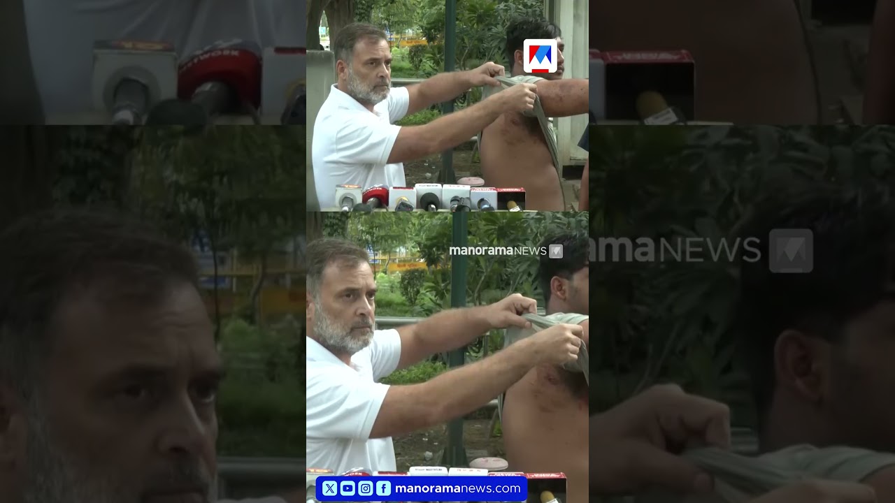'ഇതൊക്കെ പെല്ലെറ്റുകളാണ്'; പരുക്കേറ്റ വിദ്യാർഥിയുമായി  രാഹുൽ ഗാന്ധി മാധ്യമങ്ങൾക്ക് മുന്നില്&zwj; | CJP