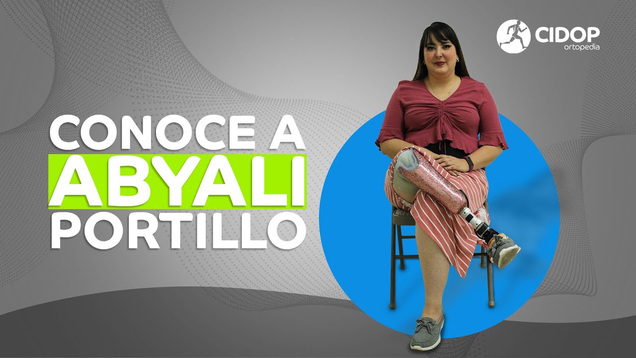 Abyali Portillo - Pr&oacute;tesis para amputaci&oacute;n por focomelia