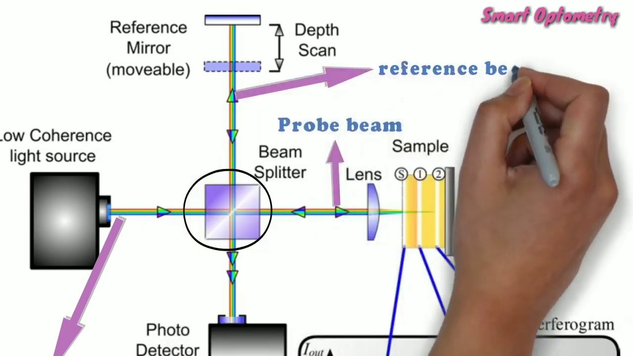 Optical Coherence Tomography - OCT (Full)