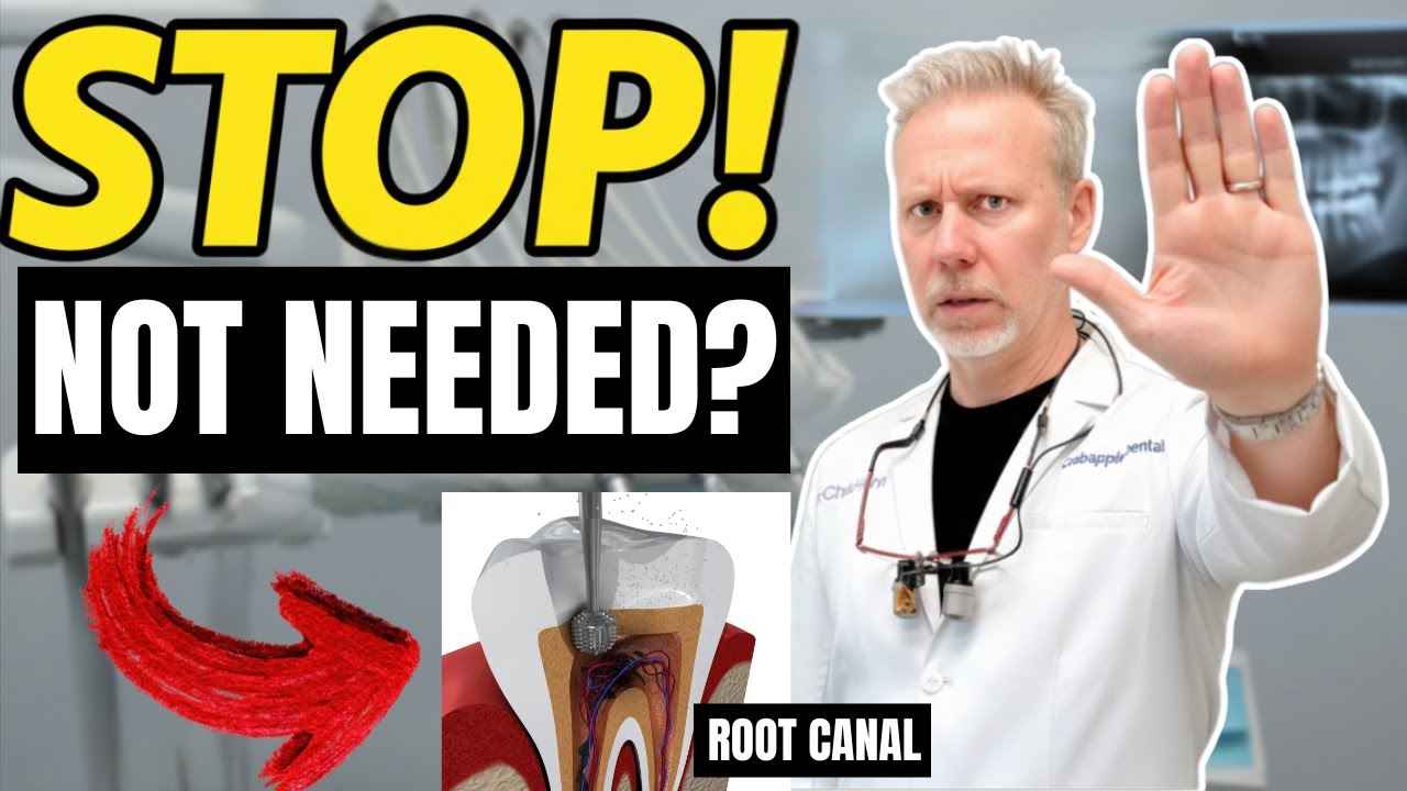 Before Getting a Root Canal Treatment… WATCH THIS