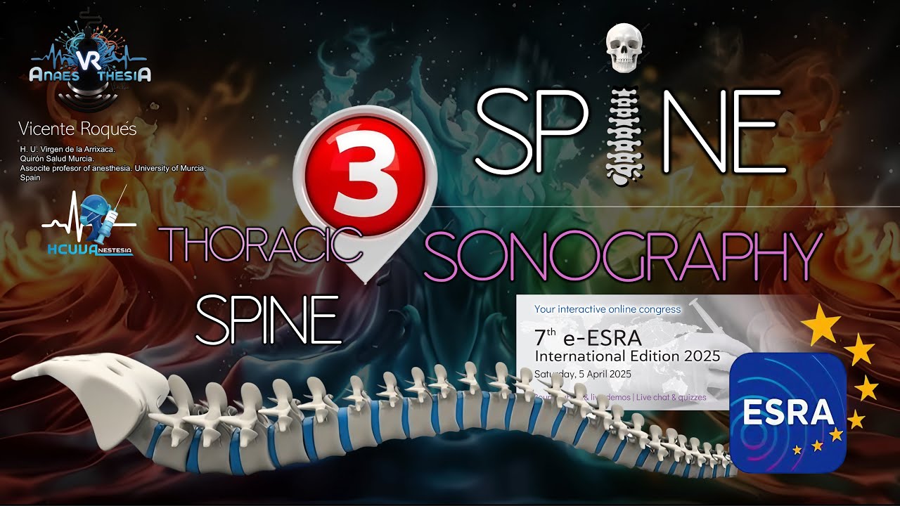 SPINE SONOGRAPHY. PART 3 (THORACIC SPINE)