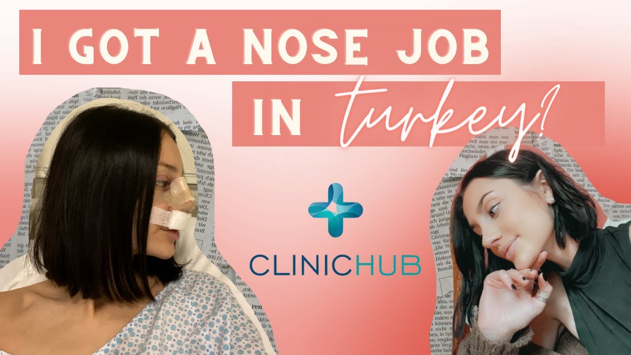 TURKEY RHINOPLASTY VLOG | My nose job with Dr. Emrah Celik