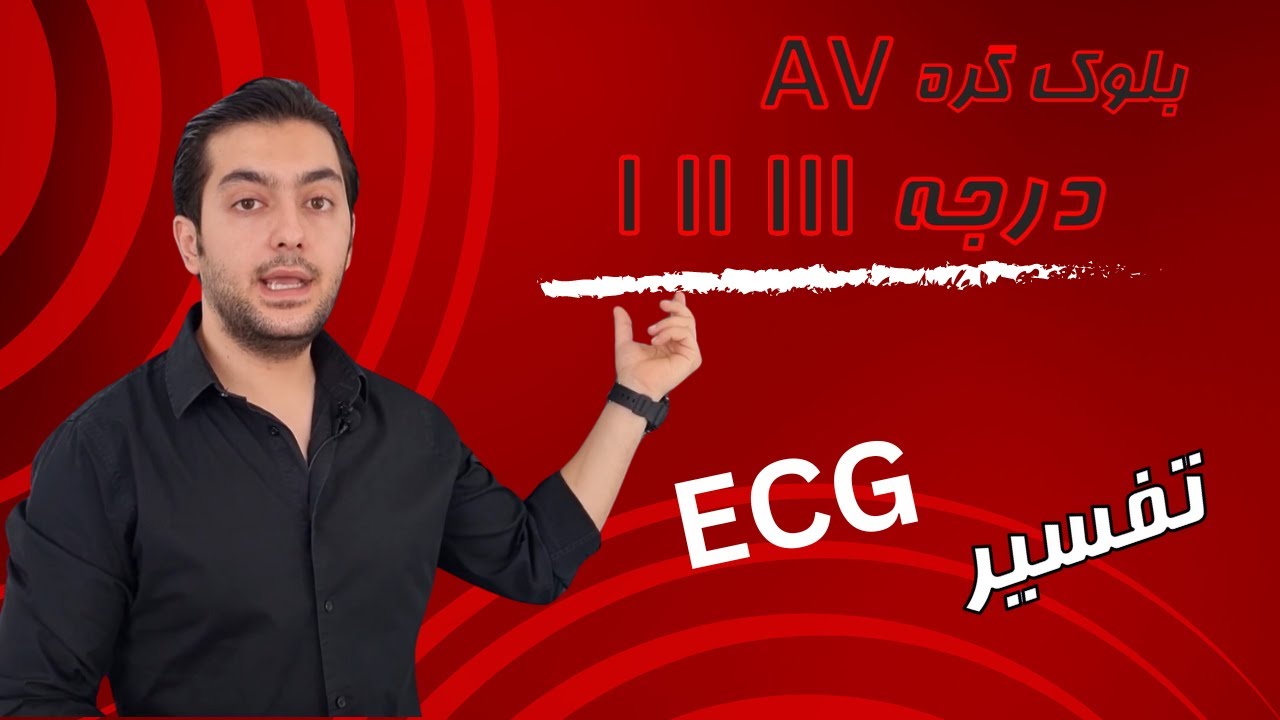 تفسیر ECG بلوک درجه AVn  I,II,III