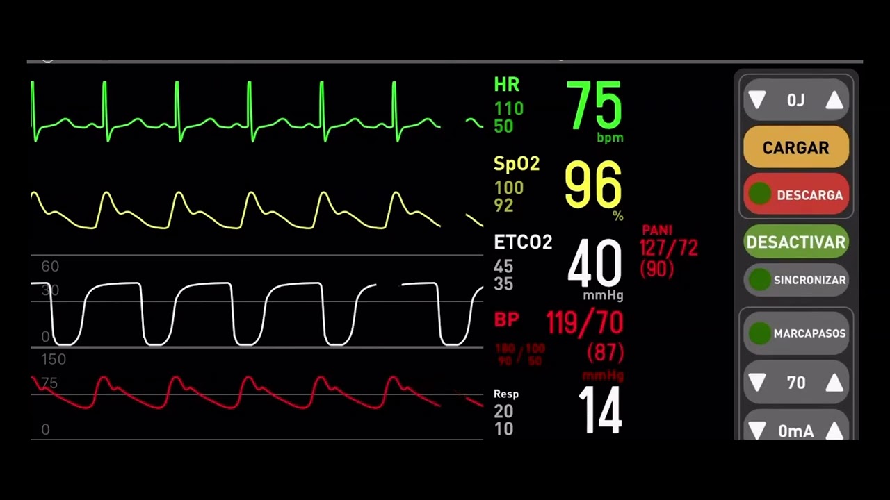 sonido ritmo cardiaco y desfibrilador