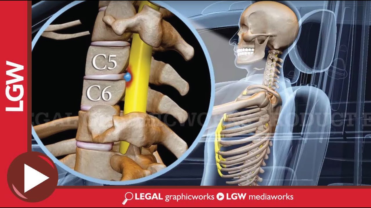 Auto Accident Recreation 3D Animation for Rear End Collision