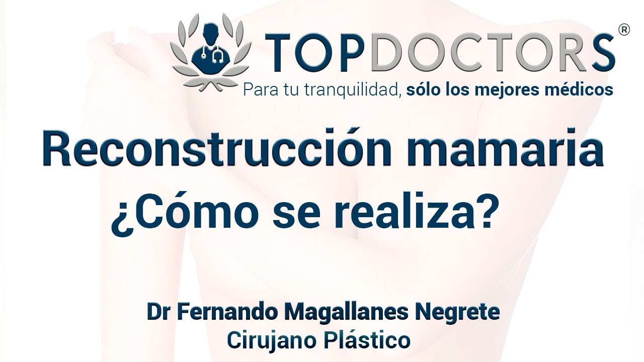 Reconstrucción mamaria post mastectomía - ¿Cómo se realiza?